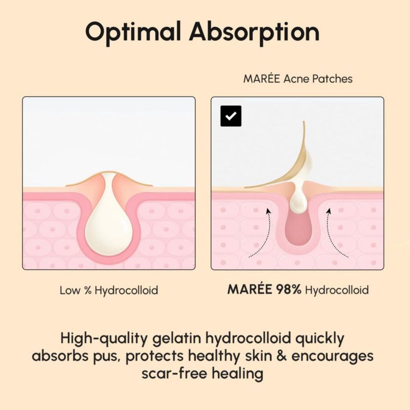 Parche antiacné MAREE Gold Star 72 unidades Hidrocoloide