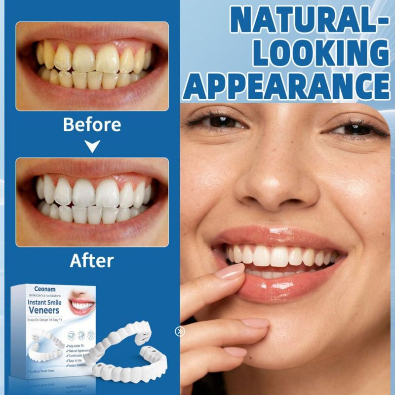 Set de Carillas Dentales Ajustables Ceonam