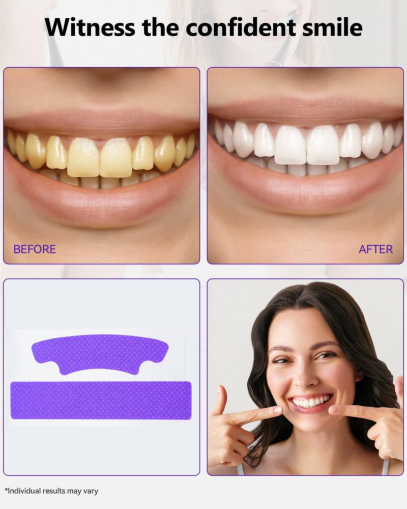 Blanqueamiento Dental Orrhomi 21 Tratamientos Púrpura para Dientes Sensibles