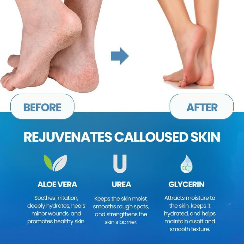 Set Imperial Feet de Spray y Lima para Callos