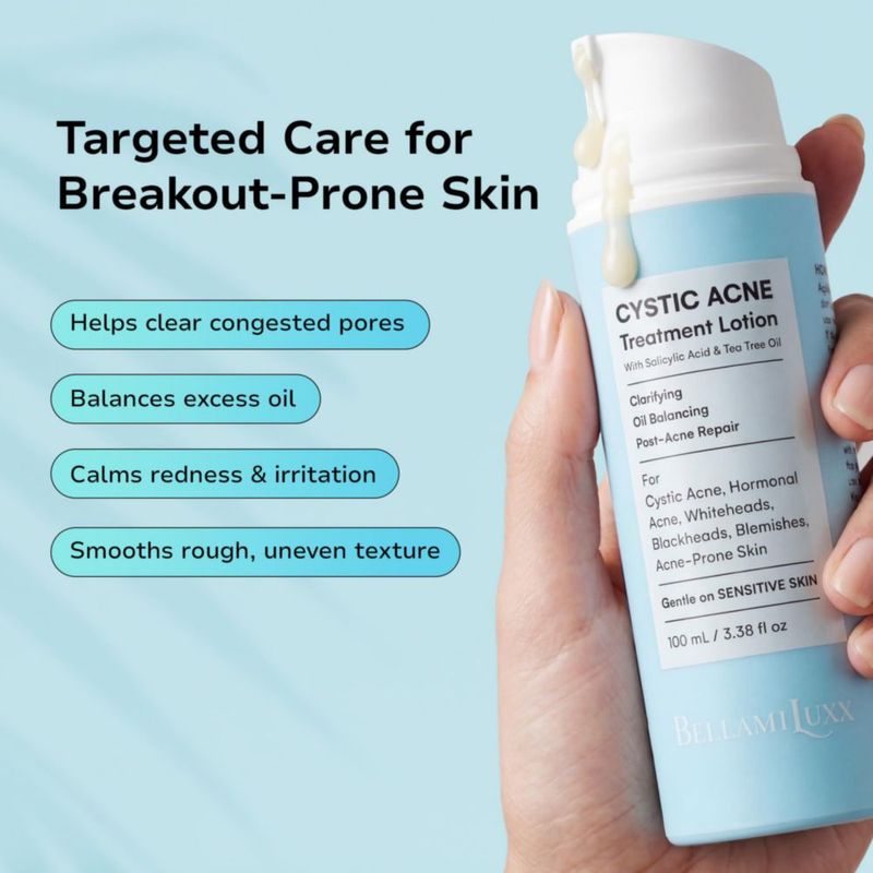 Tratamiento para el acné BellamiLuxx 100 ml Ácido Salicílico y árbol de té