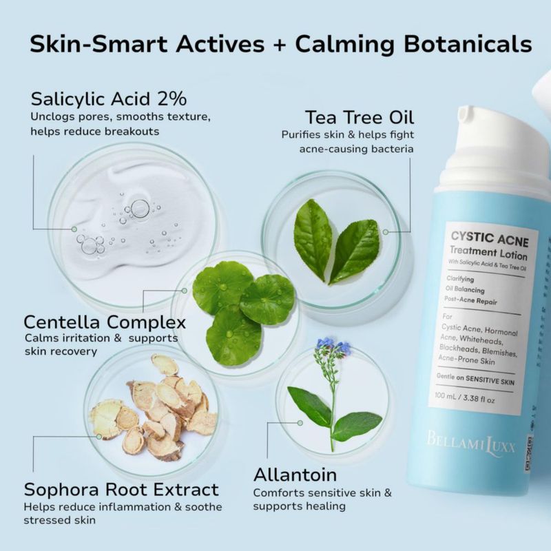 Tratamiento para el acné BellamiLuxx 100 ml Ácido Salicílico y árbol de té