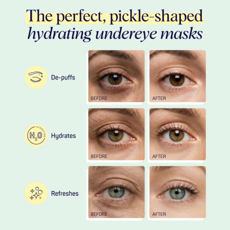 Mascarillas para ojos SpaLife – 8 pares de parches hidratantes para el contorno de ojos