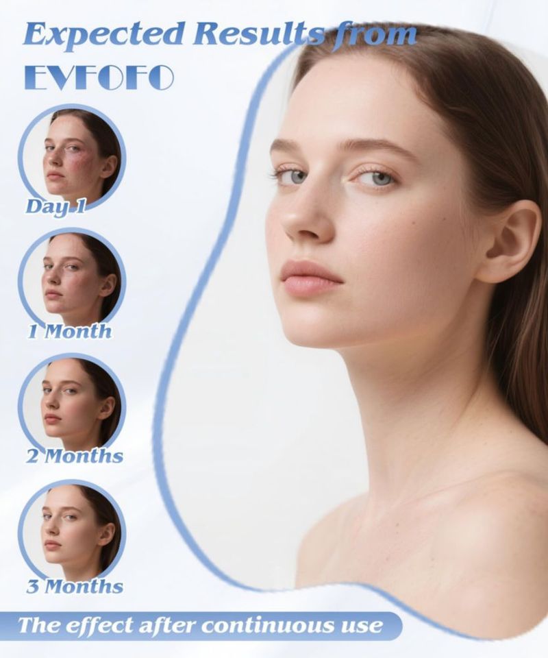 Máscara facial EVFOFO inalámbrica de LED de 7 colores (rosa)