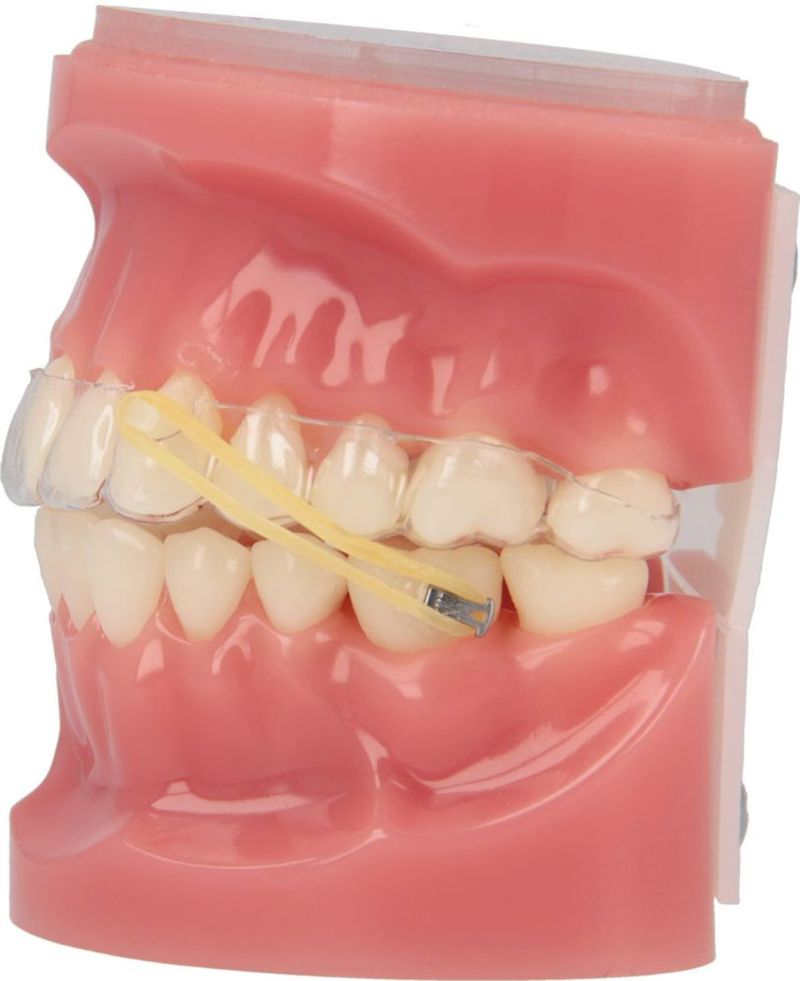 Elásticos American Orthodontics 1/8 pulgada 7 g Látex claro