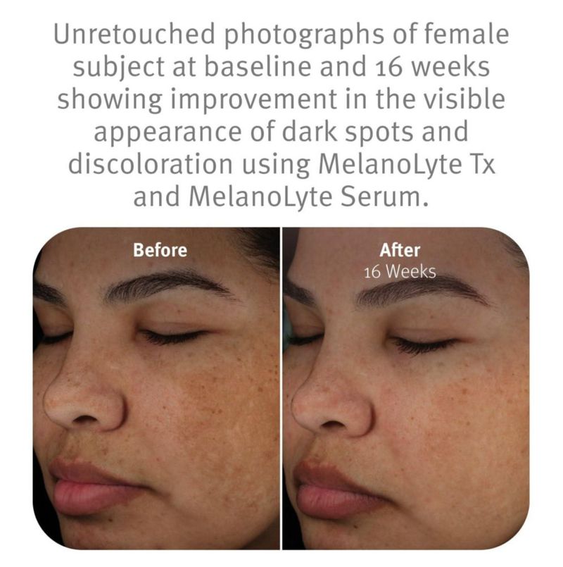 Suero Facial Epionce MelanoLyte Tx Loción Iluminadora