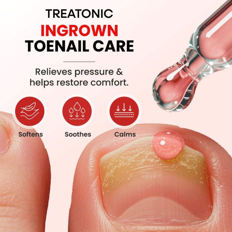 Kit de Tratamiento para Uñas Encarnadas Treatonic con Gotas
