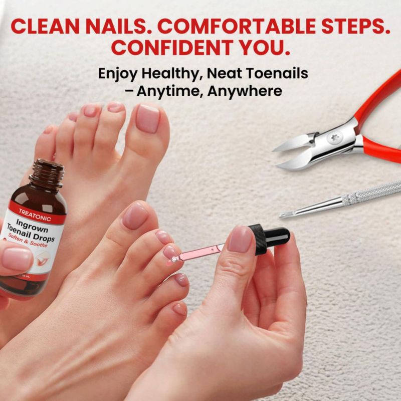 Kit de Tratamiento para Uñas Encarnadas Treatonic con Gotas