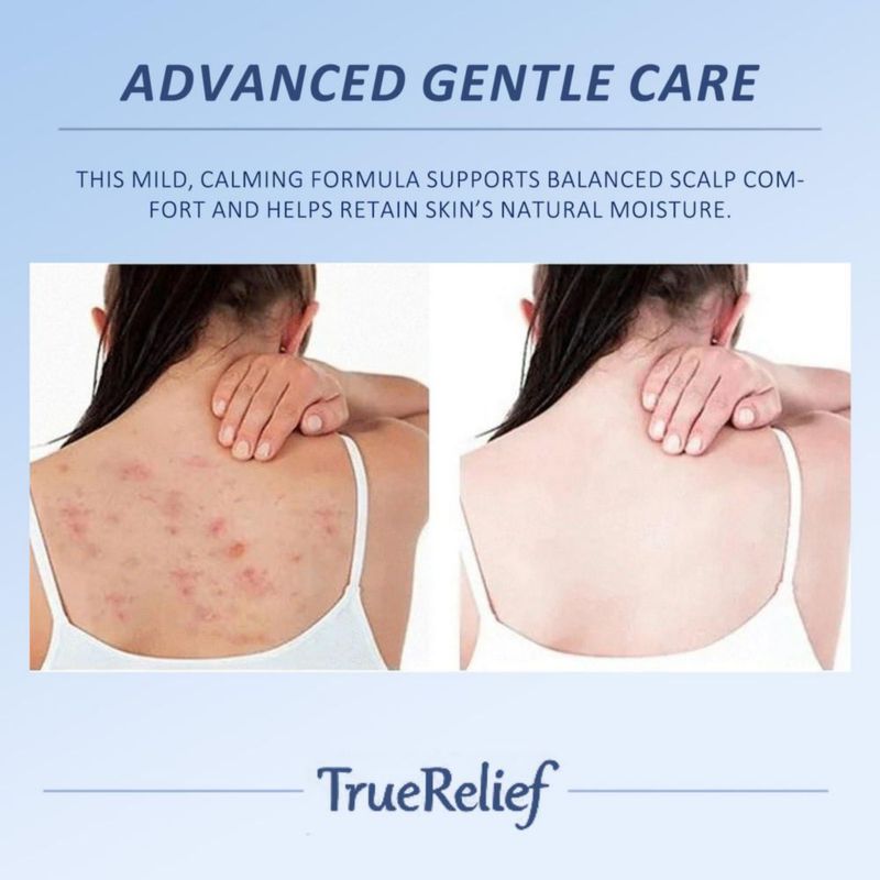 Crema para Foliculitis TRUERELIEF 120 g (423 oz)
