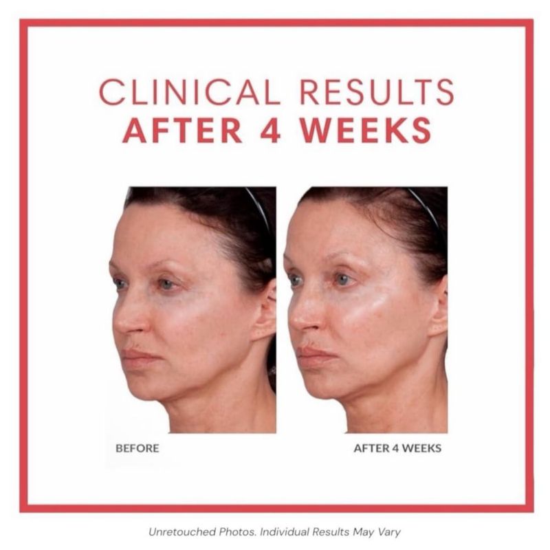 Suero Volumagen Consult Beaute 50 ml Dúo Antienvejecimiento
