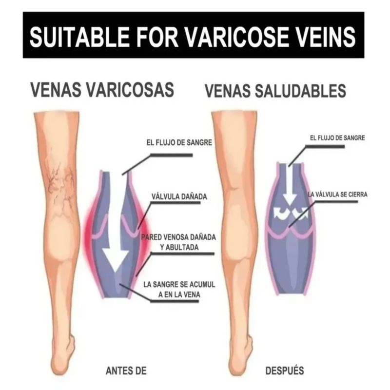 Medias De Compresión 20-30 Mmhg, 8 Pares Talla L-XL, Multicolor