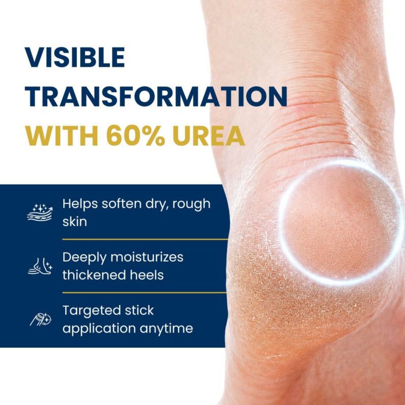 Barra de Cuidado para los Pies CALVIA 40 g Urea y Ácido Salicílico – Pack de 3