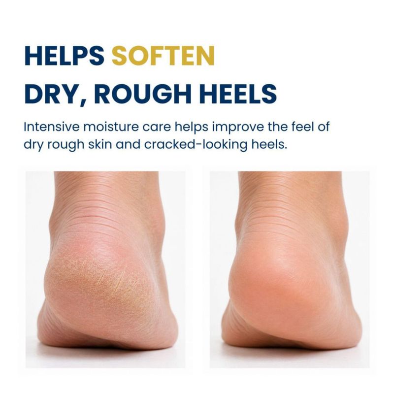 Barra de Cuidado para los Pies CALVIA 40 g Urea y Ácido Salicílico – Pack de 3