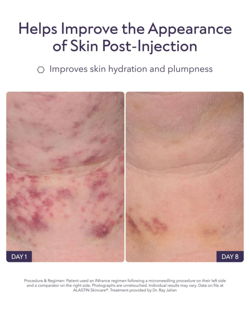 Suero ALASTIN Skincare 10 ml INhance Post‑inyección