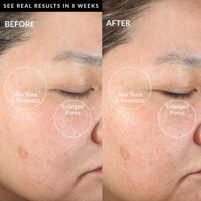 Dispositivo de limpieza facial PMD Clean con cepillo de silicona resistente al agua