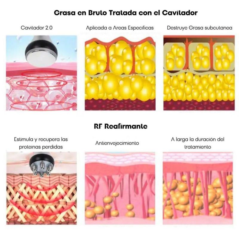 Lipolaser Cavitador 80k 9 en 1 con 8 almodadillas