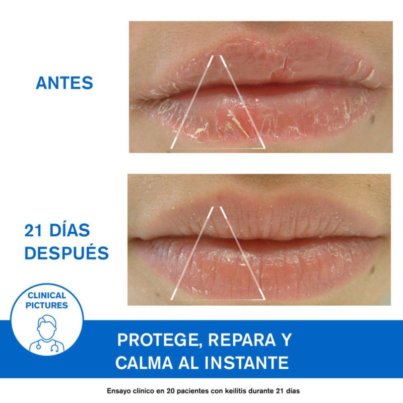 Uriage Bálsamo reparador de labios secos y agrietados 15 ml