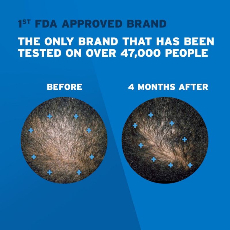 Espuma de tratamiento para el crecimiento del cabello Rogaine 5% Minoxidil Men