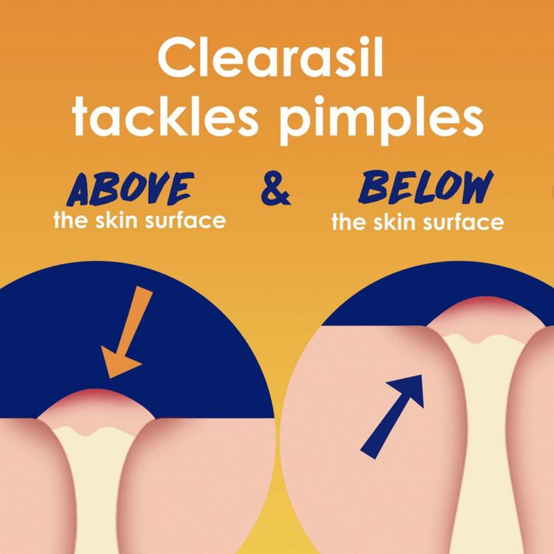 Almohadillas limpiadoras faciales Clearasil Stubborn Acne Control 90 Almohadillas