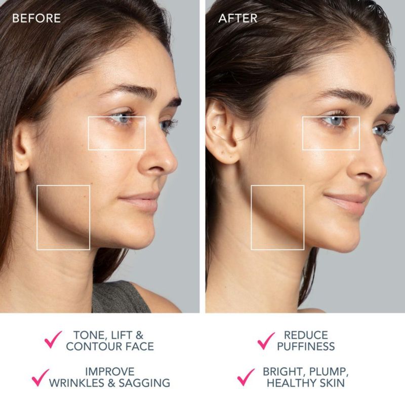 Dispositivo facial FOREO Bear 2 Advanced para levantamiento y tonificación