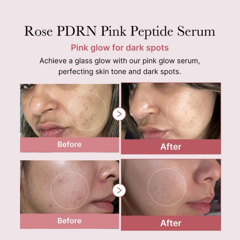 Serum Medicube Rose PDRN PDRN Pink Peptide para el cuidado de la piel vegano 30 ml