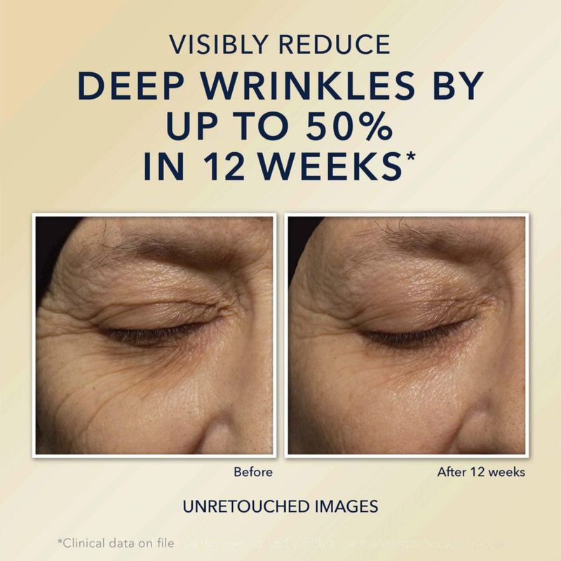 Crema de noche RoC Retinol Correxion Deep Arrugas Antiedad 30 ml