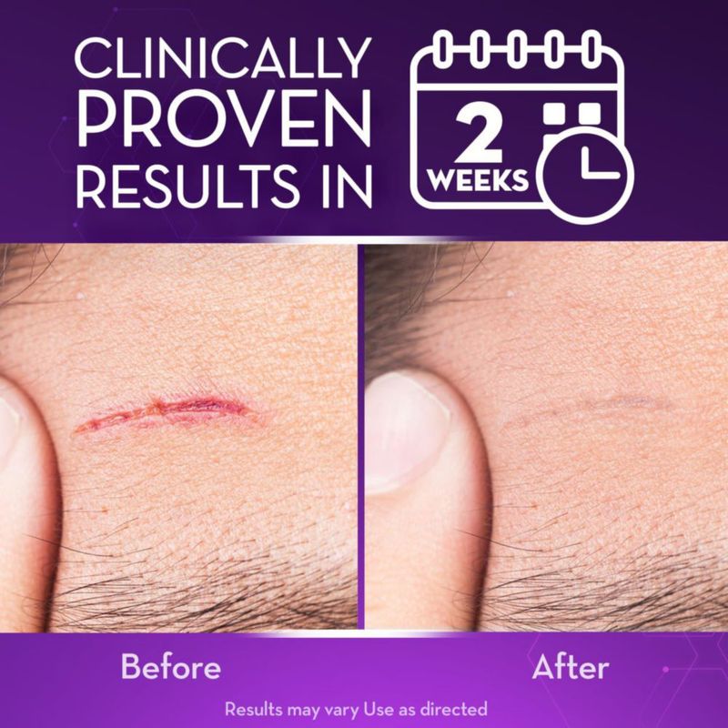 Gel para Cicatrices Cicatricure Advanced 28g para Rostro y Cuerpo