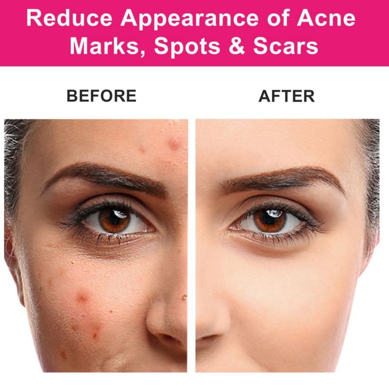 Aceite de semilla de rosa mosqueta MMPANG orgánico 30 ml para el cuidado de la cara y el cabello