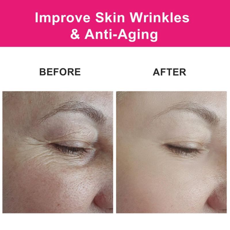 Aceite de semilla de rosa mosqueta MMPANG orgánico 30 ml para el cuidado de la cara y el cabello