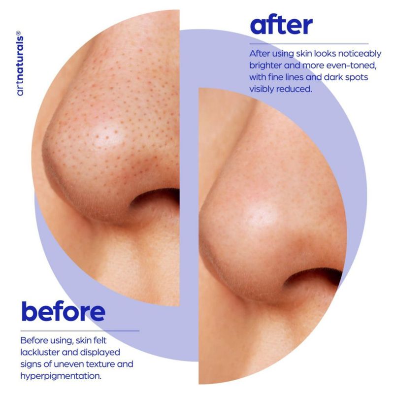 Sérum glicólico Serum artnaturals 30 ml con vitamina C y aloe