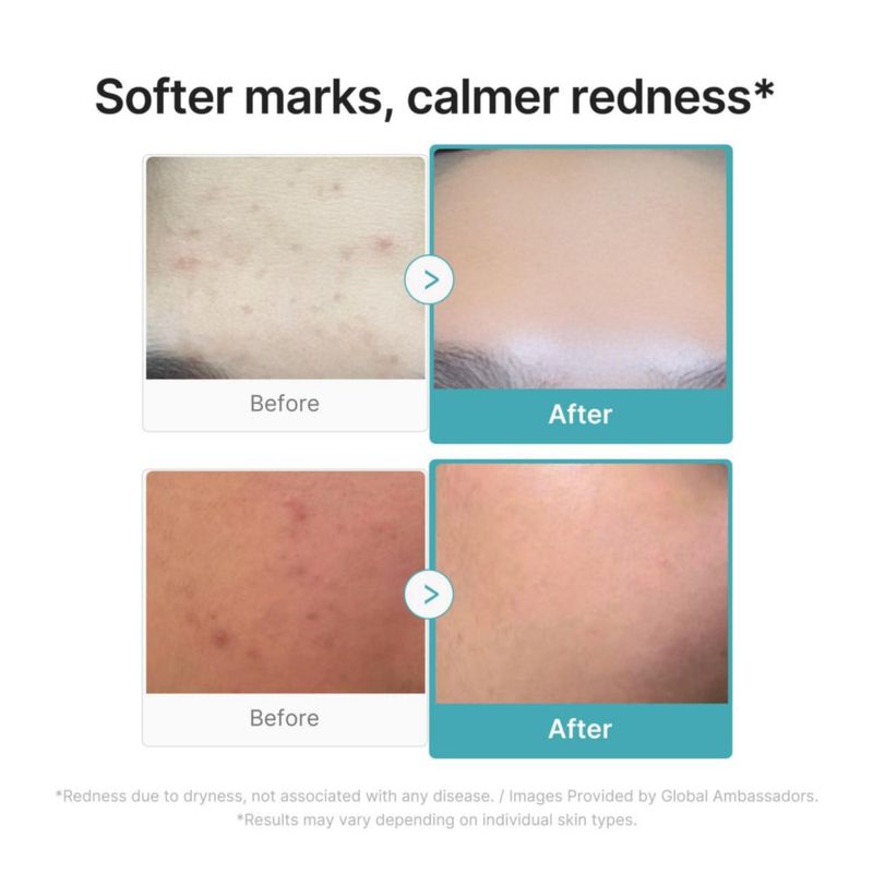 Sérum medicube con ácido azelaico 10 suavizante 30 ml para pieles con problemas