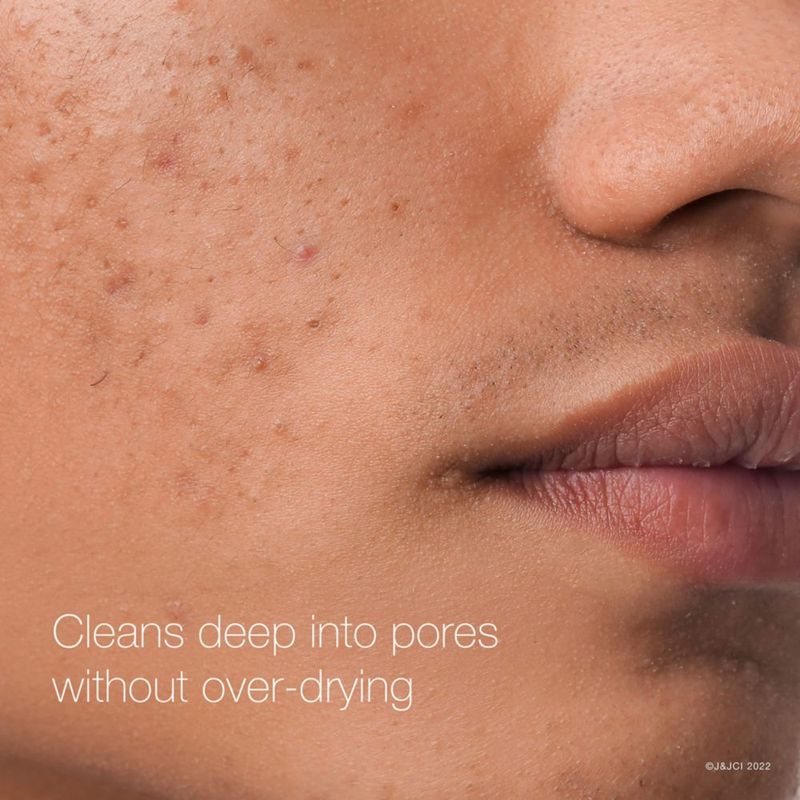 Almohadillas limpiadoras faciales Neutrogena Rapid Clear con ácido salicílico al 2%