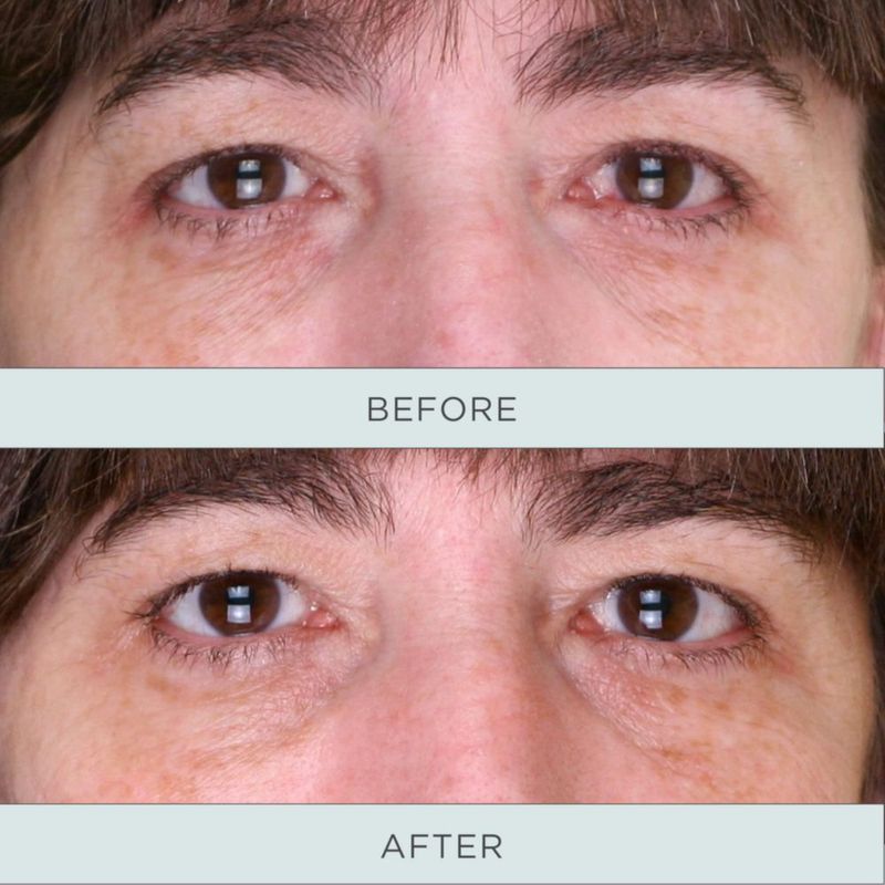 Sérum para ojos PUR MINERALS que tonifica y reafirma la niacinamida para mujeres