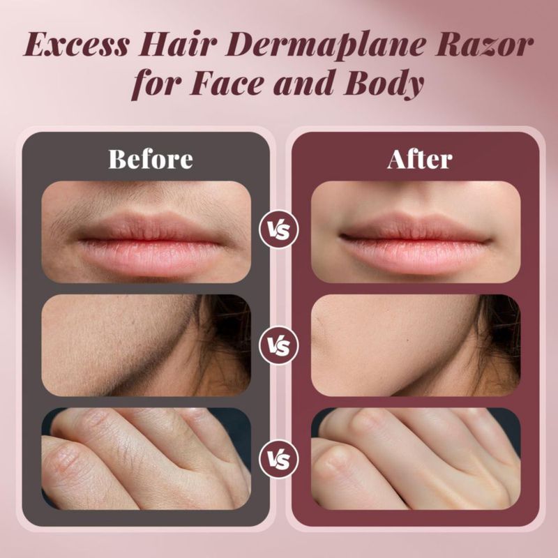 Depilador facial Dermaplane Razor BNU recargable color rosa