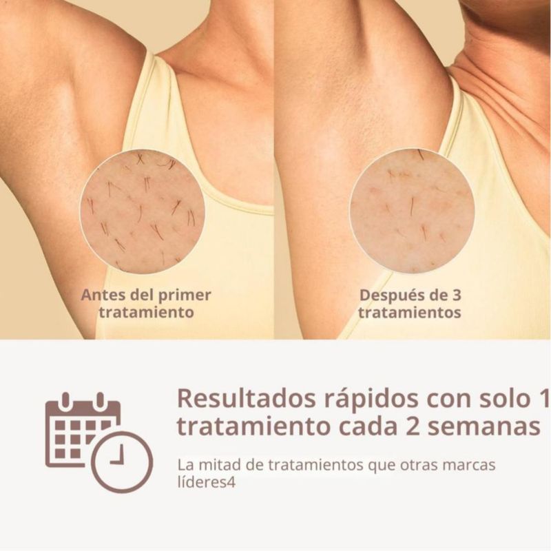 Philips Lumea Serie 7000 Depiladora IPL - Dispositivo de Depilación IPL, Reducción de Vello con Láser - Con Accesorio para Cuerpo