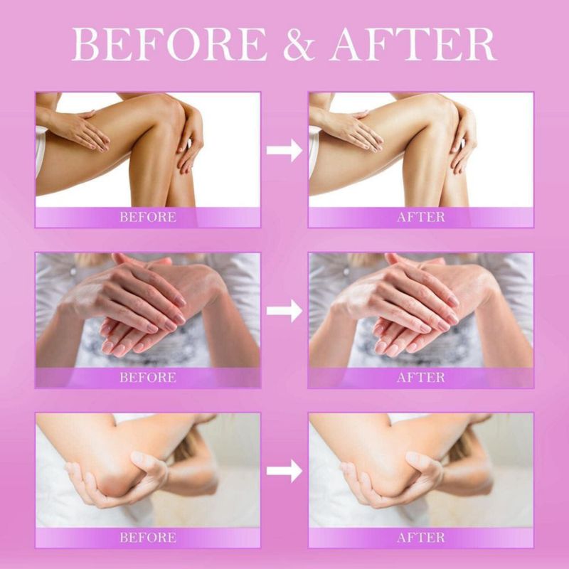 Crema correctora de manchas oscuras LOVOOD para la piel de las axilas y el cuello