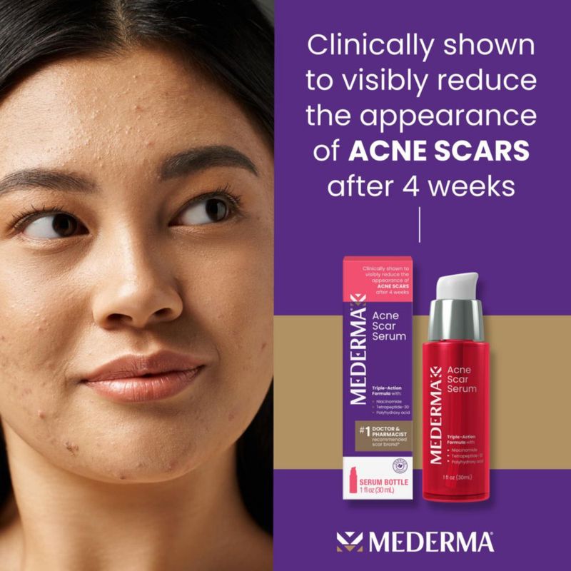 Serum Mederma Triple Acción para Cicatrices de Acné 30 ml