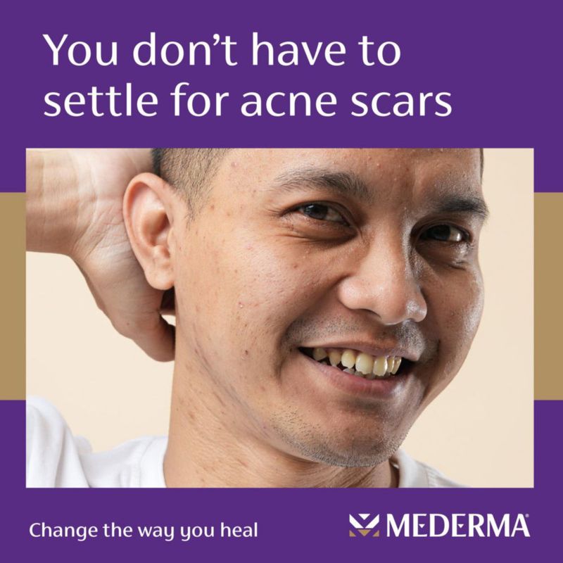 Serum Mederma Triple Acción para Cicatrices de Acné 30 ml
