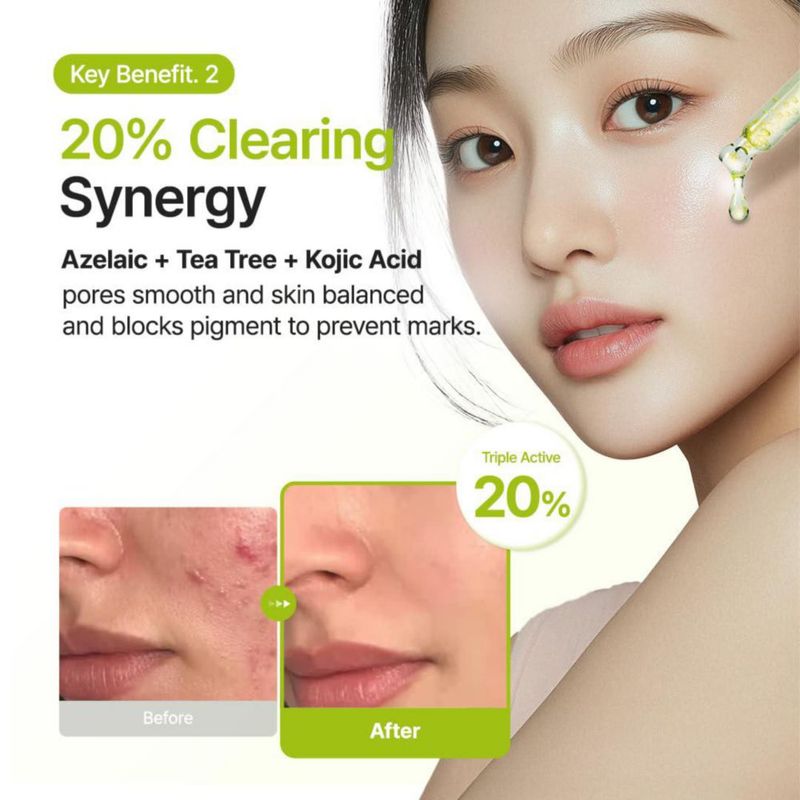Sérum facial PURITO con ácido azelaico 10% ácido kójico y árbol de té 30 ml