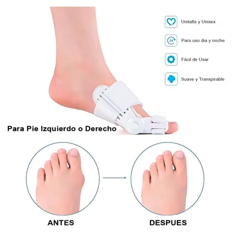 Correctores Ortopédico Juanete Dedo Del Pie Separador, Color Blanco