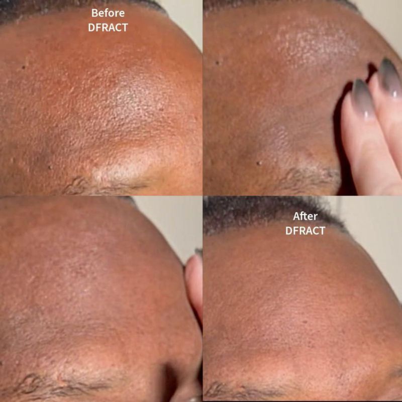 Prebase de Maquillaje DFRACT Invisible Blur Bálsamo 30 ml
