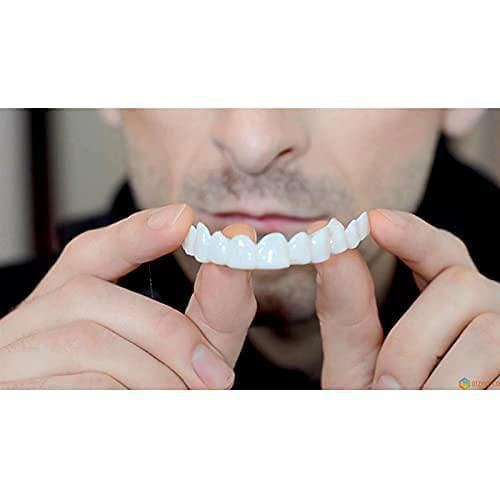 Carillas dentales sowsmile Comfort Fit Flex Molde