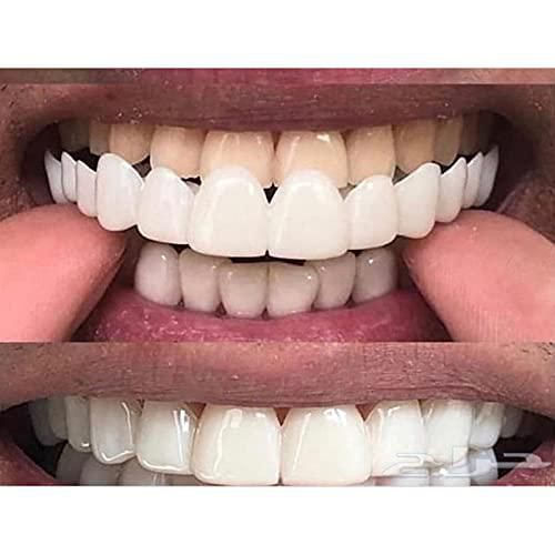 Carillas dentales sowsmile Comfort Fit Flex Molde