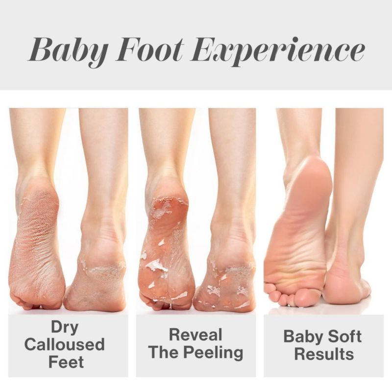 Eliminador de callos exfoliante Foot Peel Baby Foot Original