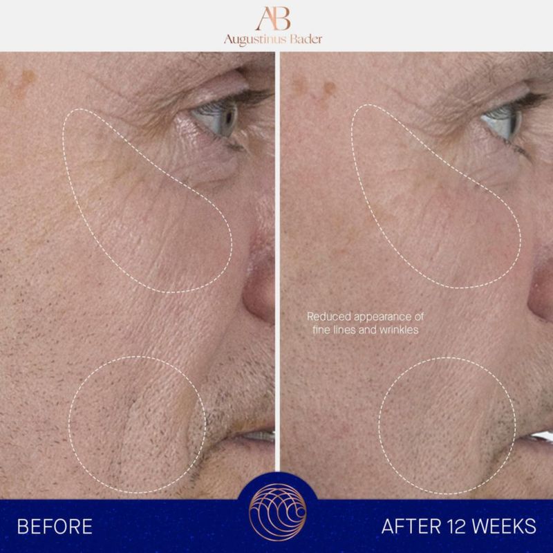 Suero facial Augustinus Bader 15 ml