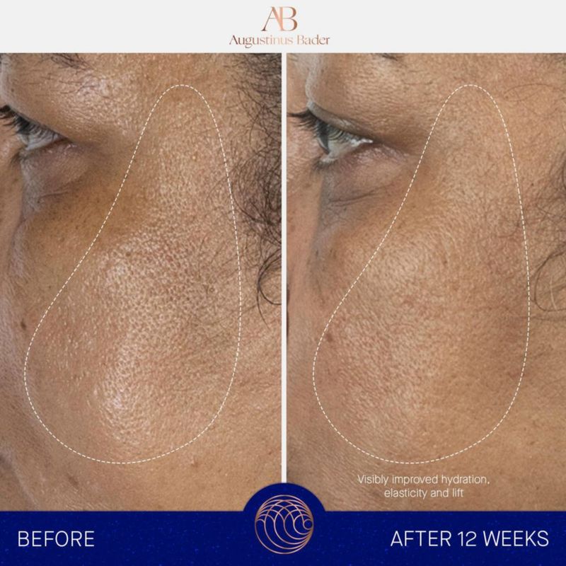 Suero facial Augustinus Bader 15 ml