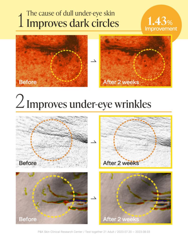 Parche para ojos Medianswer Vita Colágeno 60 unidades