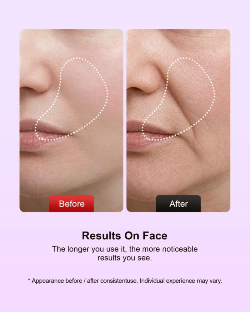 Masajeador facial Pedete 7 colores con terapia de luz roja