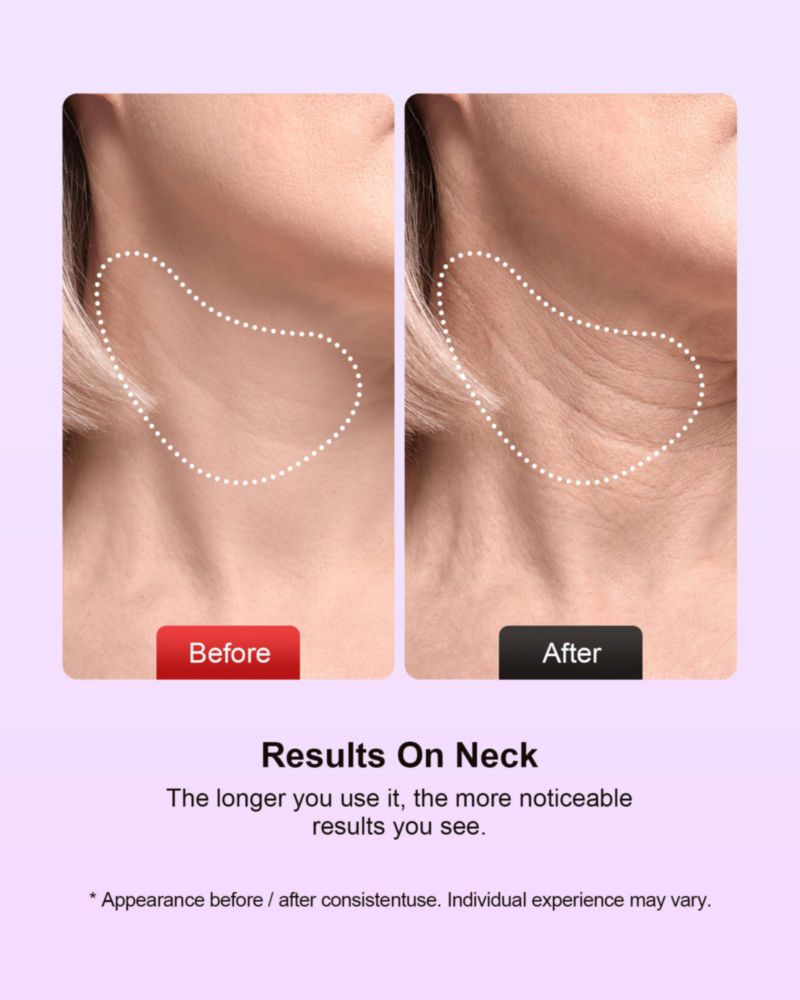 Masajeador facial Pedete 7 colores con terapia de luz roja