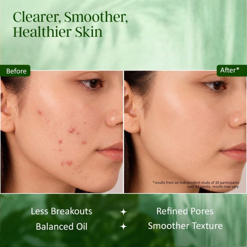 Jabón Exfoliante INDIAN SECRETS 110 g 3 unidades Ácido Salicílico